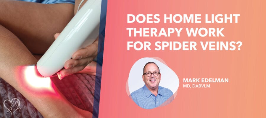 At-Home Light Therapy for Spider Veins